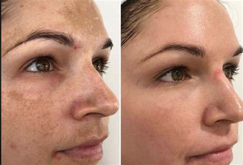 Cosmeleon .